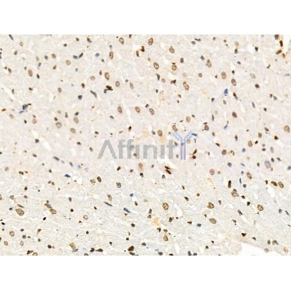 Acetyl-Histone H4 (Lys91) Antibody - AF4357 at 1/100 staining Rat liver tissue by IHC-P.