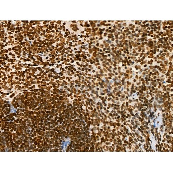 Acetyl-p53 (Lys373) Antibody - AF4363 at 1/100 staining Mouse spleen tissue by IHC-P.
