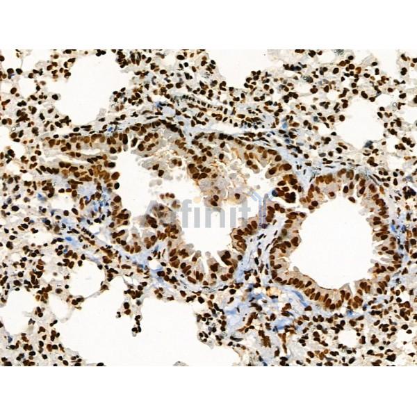 Acetyl-p53 (Lys373) Antibody - AF4363 at 1/100 staining Mouse lung tissue by IHC-P.