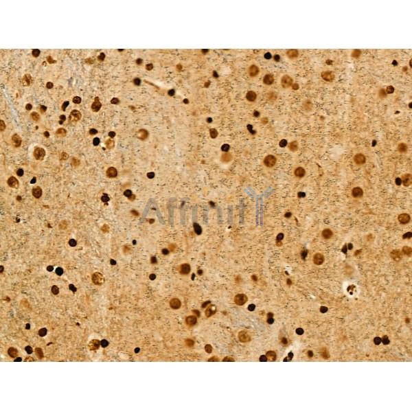 Acetyl-p53 (Lys373) Antibody - AF4363 at 1/100 staining Mouse brain tissue by IHC-P.