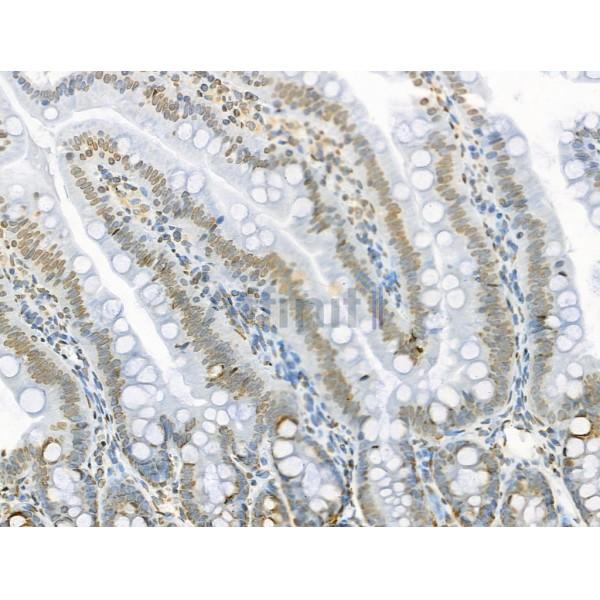 Acetyl-p53 (Lys373) Antibody - AF4363 at 1/100 staining Rat colorectal tissue by IHC-P.