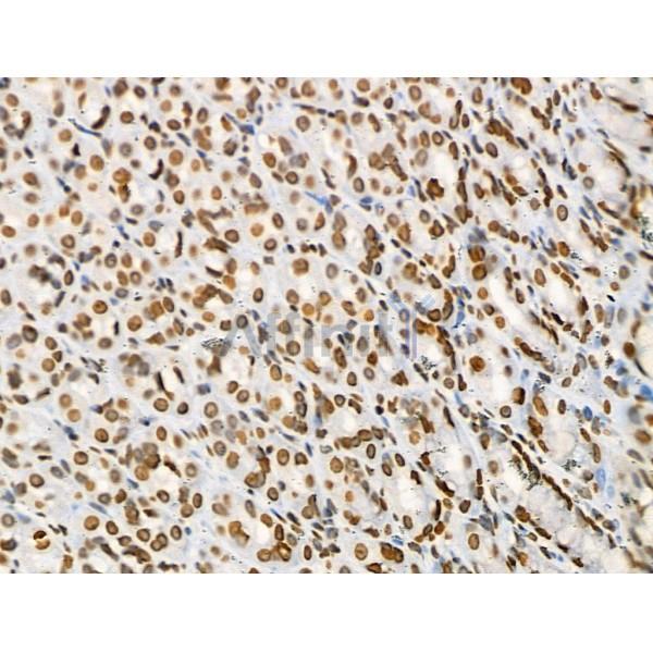Acetyl-p53 (Lys373) Antibody - AF4363 at 1/100 staining Rat stomach tissue by IHC-P.