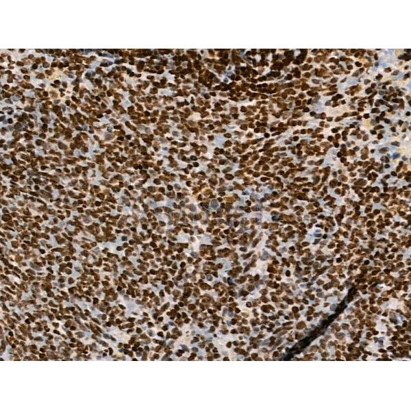 Acetyl-H2A.Z (Lys4/7/11/13) Antibody - AF4366 at 1/100 staining Rat spleen tissue by IHC-P.