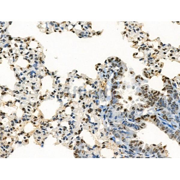 Acetyl-H2A.Z (Lys4/7/11/13) Antibody - AF4366 at 1/100 staining Mouse lung tissue by IHC-P.