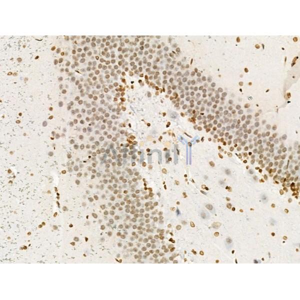 Acetyl-H2A.Z (Lys4/7/11/13) Antibody - AF4366 at 1/100 staining Rat brain tissue by IHC-P.