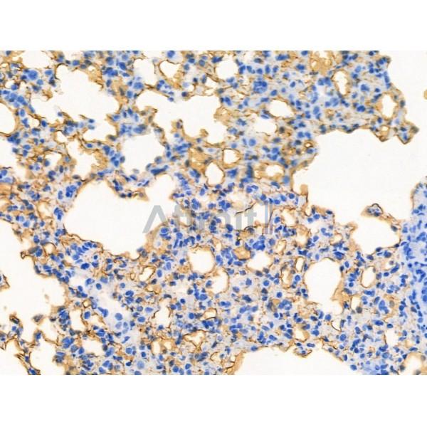 Phospho-Oxytocin Receptor (Thr235) Antibody - AF4367 at 1/100 staining Mouse lung tissue by IHC-P.