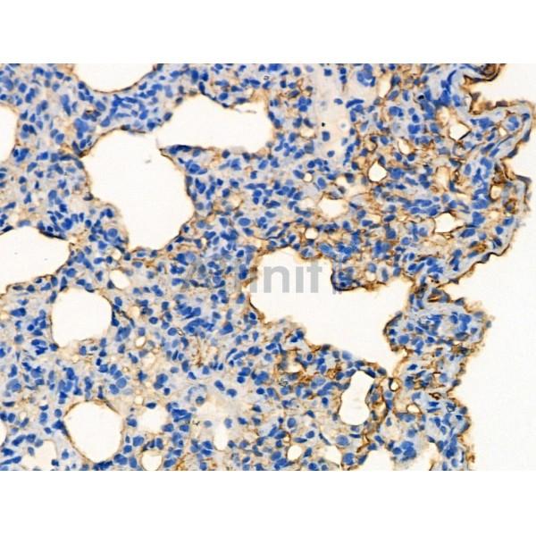 Phospho-Oxytocin Receptor (Thr235) Antibody - AF4367 at 1/100 staining Rat lung tissue by IHC-P.