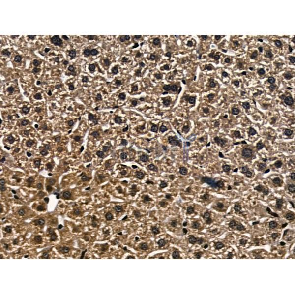 E2F5 Antibody - AF5137 at 1/100 staining Mouse liver tissue by IHC-P.