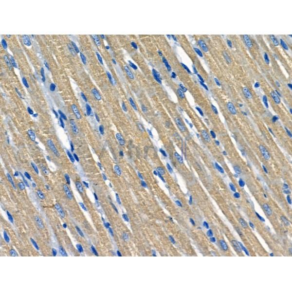 SOD2/MnSOD Antibody - AF5144 at 1/100 staining Mouse skin tissue by IHC-P.