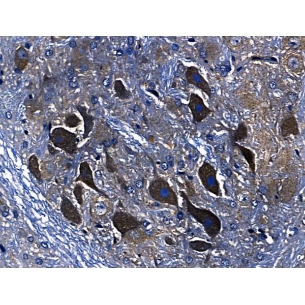 Annexin III Antibody - AF5159 at 1/100 staining Rat brain tissue by IHC-P.