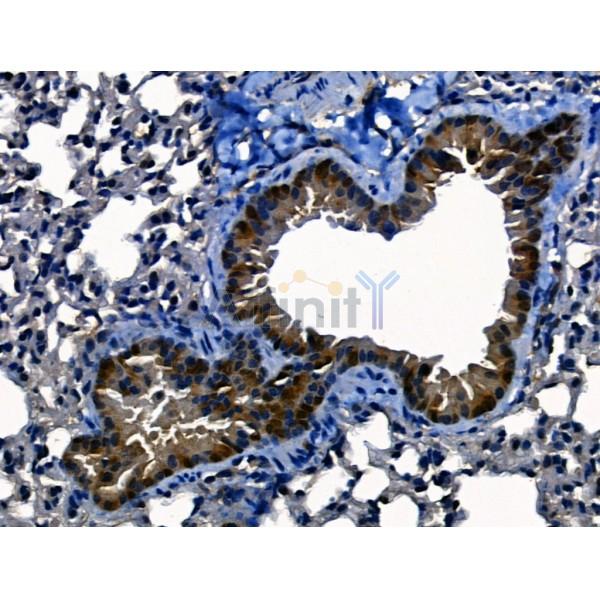 ACE2 Antibody - AF5165 at 1/100 staining Mouse lung tissue by IHC-P.