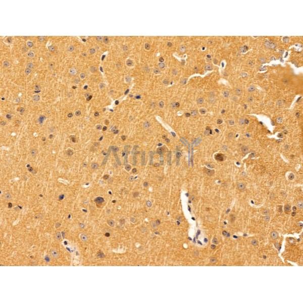 IL11 Antibody - AF5211 at 1/100 staining Mouse brain tissue by IHC-P.