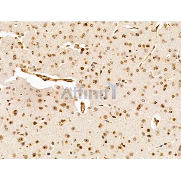 HMGA1 Antibody - AF5218 at 1/100 staining Mouse brain tissue by IHC-P.