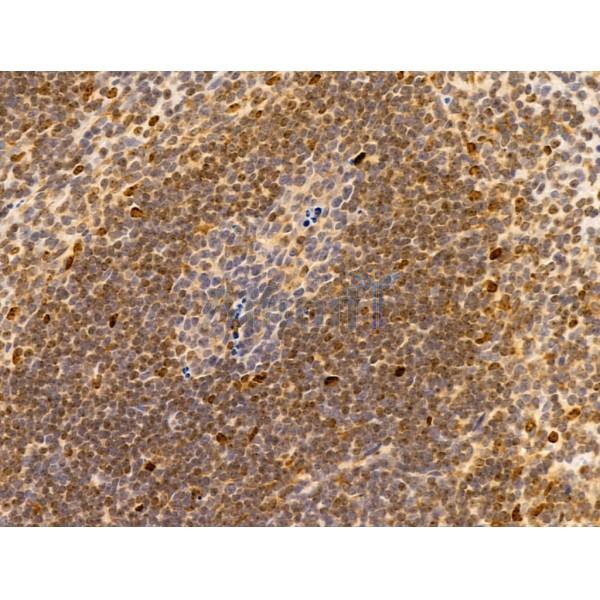 HMGA1 Antibody - AF5218 at 1/100 staining Mouse spleen tissue by IHC-P.