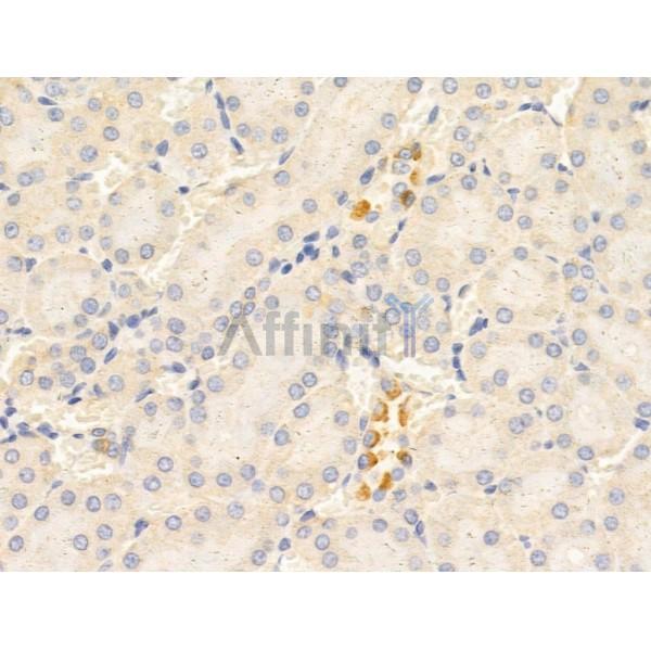 TYK2 Antibody - AF5223 at 1/100 staining Rat kidney tissue by IHC-P.