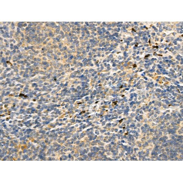 CD83 Antibody - AF5233 at 1/100 staining Mouse spleen tissue by IHC-P.