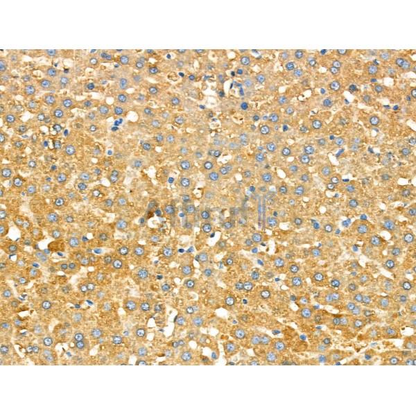 Galectin-9 Antibody - AF5290 at 1/100 staining Rat liver tissue by IHC-P.