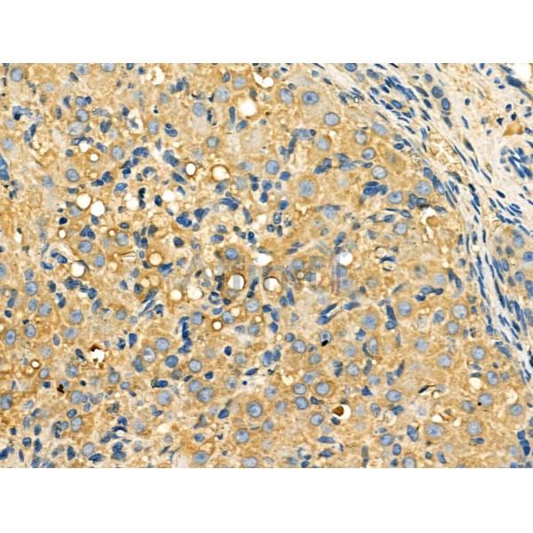 Galectin-9 Antibody - AF5290 at 1/100 staining Rat spleen tissue by IHC-P.