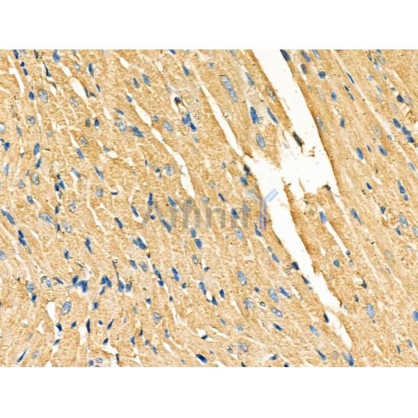 Galectin-9 Antibody - AF5290 at 1/100 staining Rat heart tissue by IHC-P.