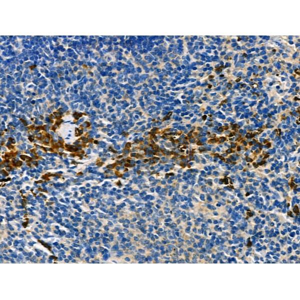 CMKLR1 Antibody - AF5291 at 1/100 staining Mouse spleen tissue by IHC-P.