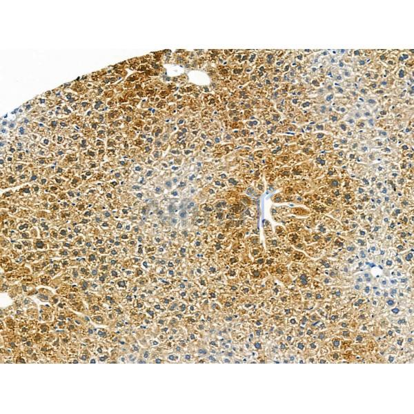 CMKLR1 Antibody - AF5291 at 1/100 staining Mouse liver tissue by IHC-P.