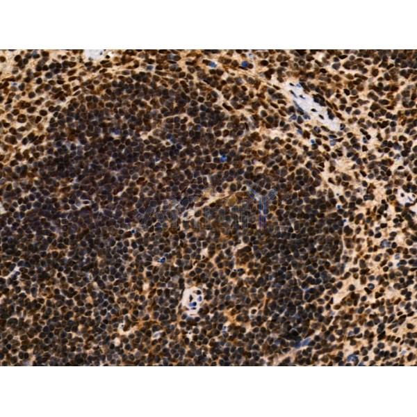 LEG7 Antibody - AF5300 at 1/100 staining Mouse spleen tissue by IHC-P.