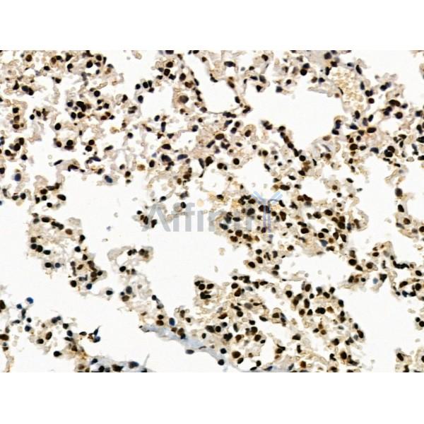 LEG7 Antibody - AF5300 at 1/100 staining Mouse lung tissue by IHC-P.