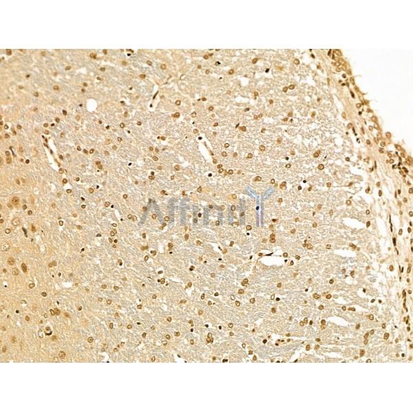 Cyclin A1 Antibody - AF5313 at 1/100 staining Rat brain tissue by IHC-P.