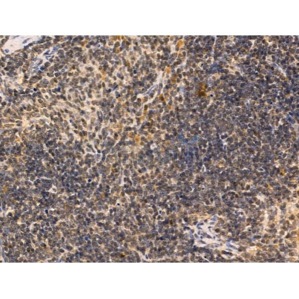 AP2 alpha Antibody - AF5323 at 1/100 staining Mouse spleen tissue by IHC-P.