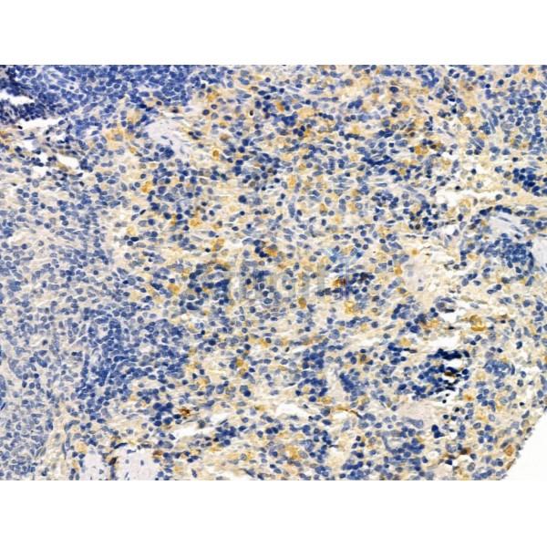 MMP8 Antibody - AF5446 at 1/100 staining Rat spleen tissue by IHC-P.