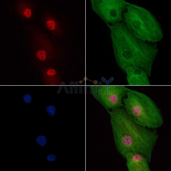 Smad2 Antibody - AF6449 staining A549 cells by IF/ICC.
