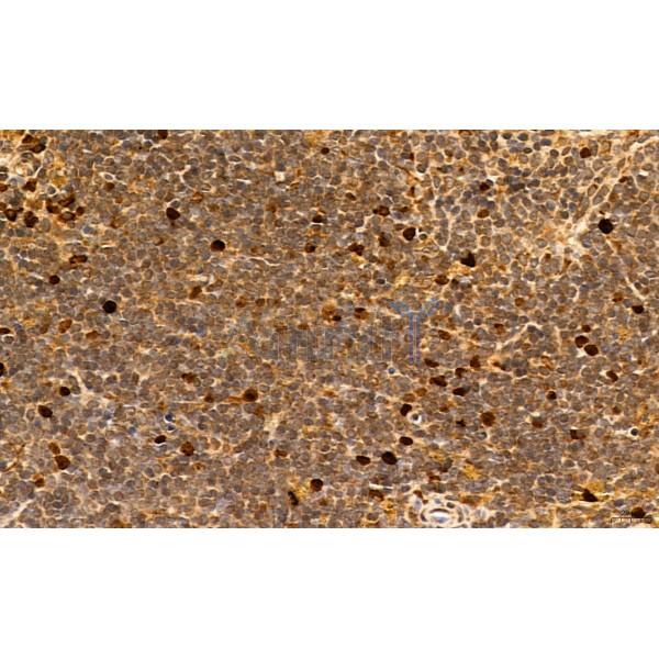 Foxp3 Antibody - AF6544 at 1/100 staining mouse spleen tissue by IHC-P.