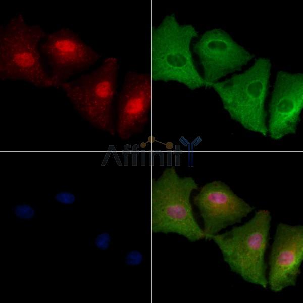 MAGEA12 Antibody - DF10034 staining A549 cells by IF/ICC.