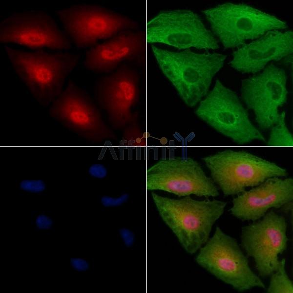MAGH1 Antibody - DF10043 staining A549 cells by IF/ICC.