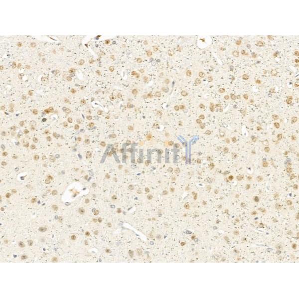 IL1F7 Antibody - DF10112 at 1/100 staining Mouse brain tissue by IHC-P.