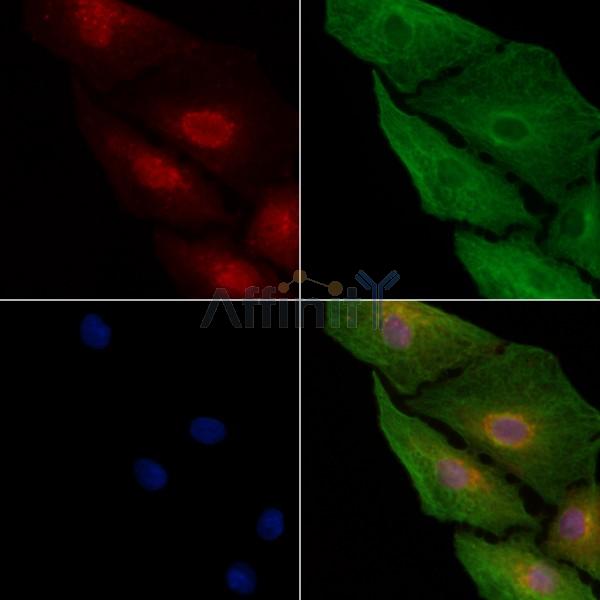 COMMD1 Antibody - DF12068 staining A549 cells by IF/ICC.