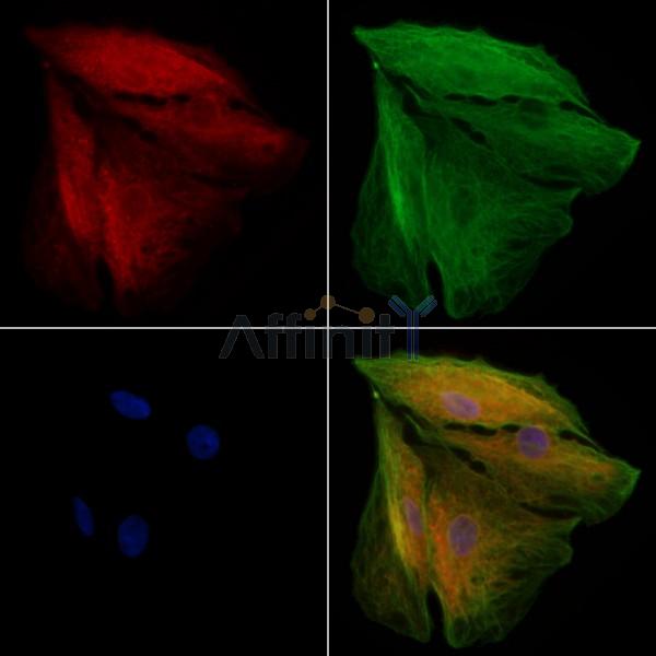 NOD2 Antibody - DF12125 staining A549 cells by IF/ICC.