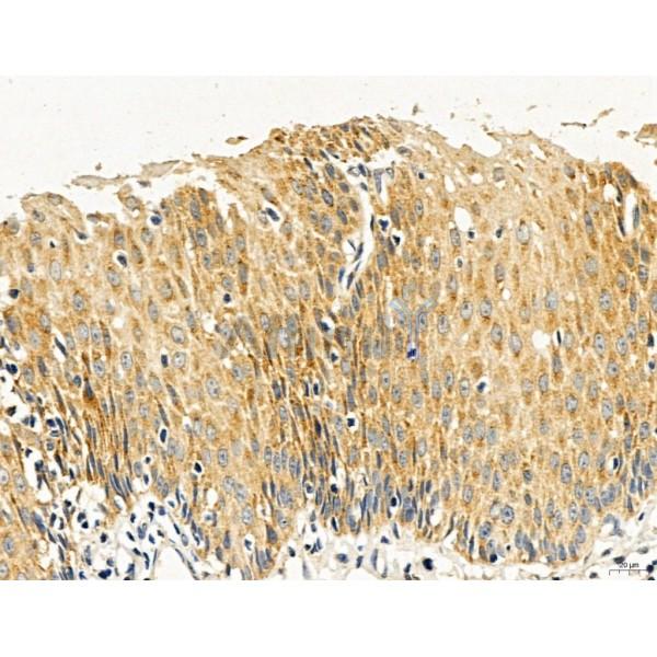 Estrogen Sulfotransferase Antibody - DF12137 at 1/100 staining Human normal tissues adjacent to esophageal cancer by IHC-P.