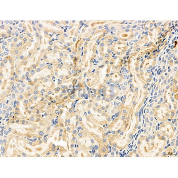 Estrogen Sulfotransferase Antibody - DF12137 at 1/100 staining Rat kidney tissue by IHC-P.