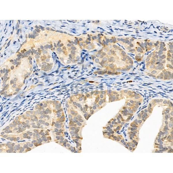 Estrogen Sulfotransferase Antibody - DF12137 at 1/100 staining Rat ovary tissue by IHC-P.
