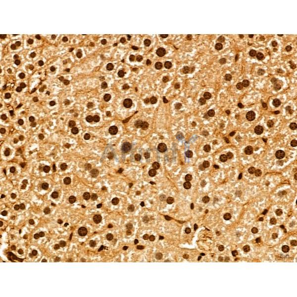 ADRM1 Antibody - DF12142 at 1/100 staining Mouse liver tissue by IHC-P.