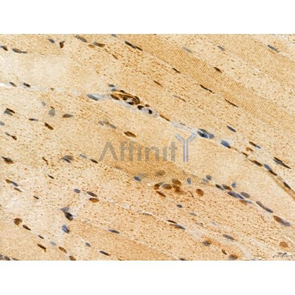 ADRM1 Antibody - DF12142 at 1/100 staining Rat muscle tissue by IHC-P.