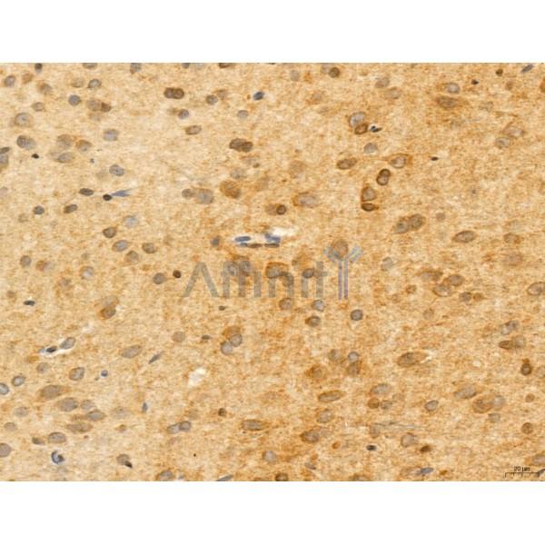 ADRM1 Antibody - DF12142 at 1/100 staining Rat brain tissue by IHC-P.