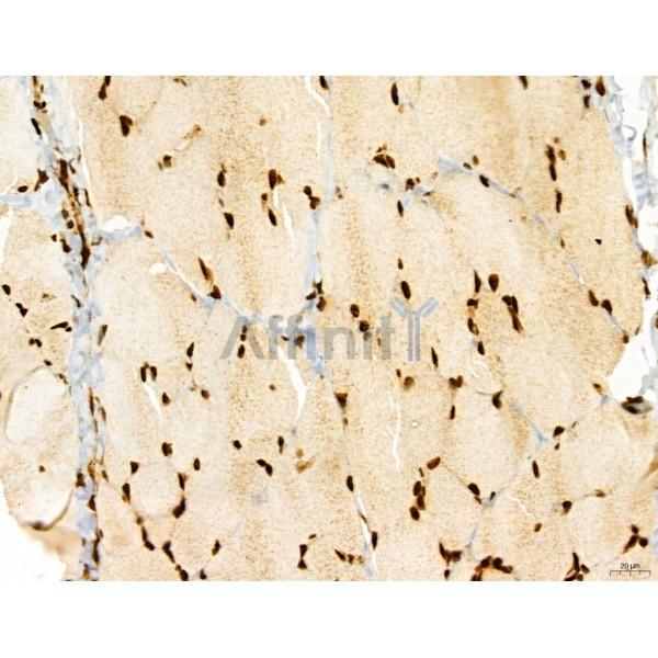 ADRM1 Antibody - DF12142 at 1/100 staining Rat skin tissue by IHC-P.