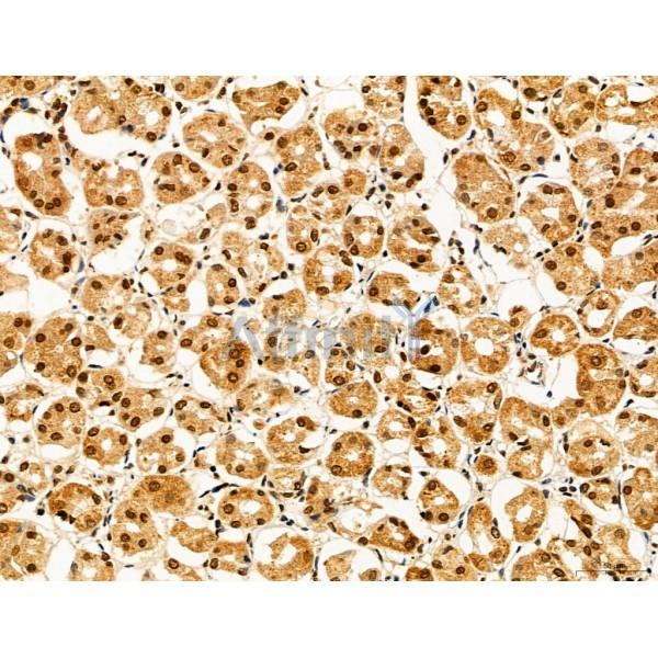 ADRM1 Antibody - DF12142 at 1/100 staining Human normal tissues adjacent to gastric cancer by IHC-P.