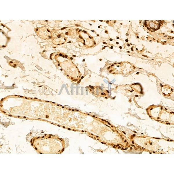 ADRM1 Antibody - DF12142 at 1/100 staining Human normal tissues adjacent to colorectal cancer by IHC-P.