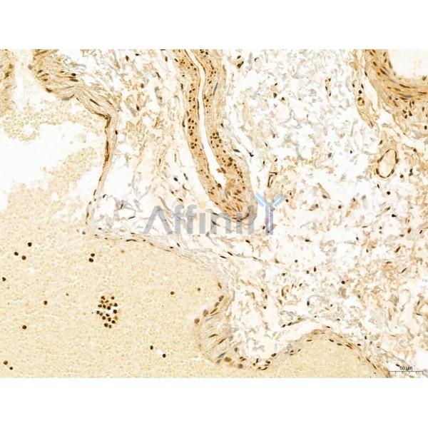 ADRM1 Antibody - DF12142 at 1/100 staining Human normal tissues adjacent to esophageal cancer by IHC-P.