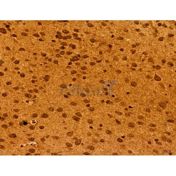 ADRM1 Antibody - DF12142 at 1/100 staining Mouse brain tissue by IHC-P.
