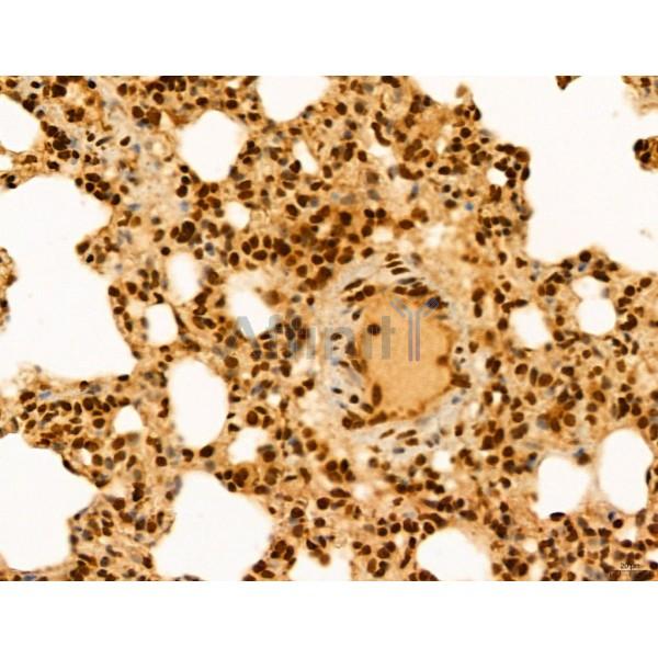 ADRM1 Antibody - DF12142 at 1/100 staining Rat lung tissue by IHC-P.