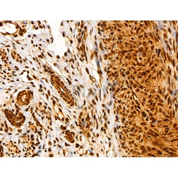 ADRM1 Antibody - DF12142 at 1/100 staining Rat ovary tissue by IHC-P.